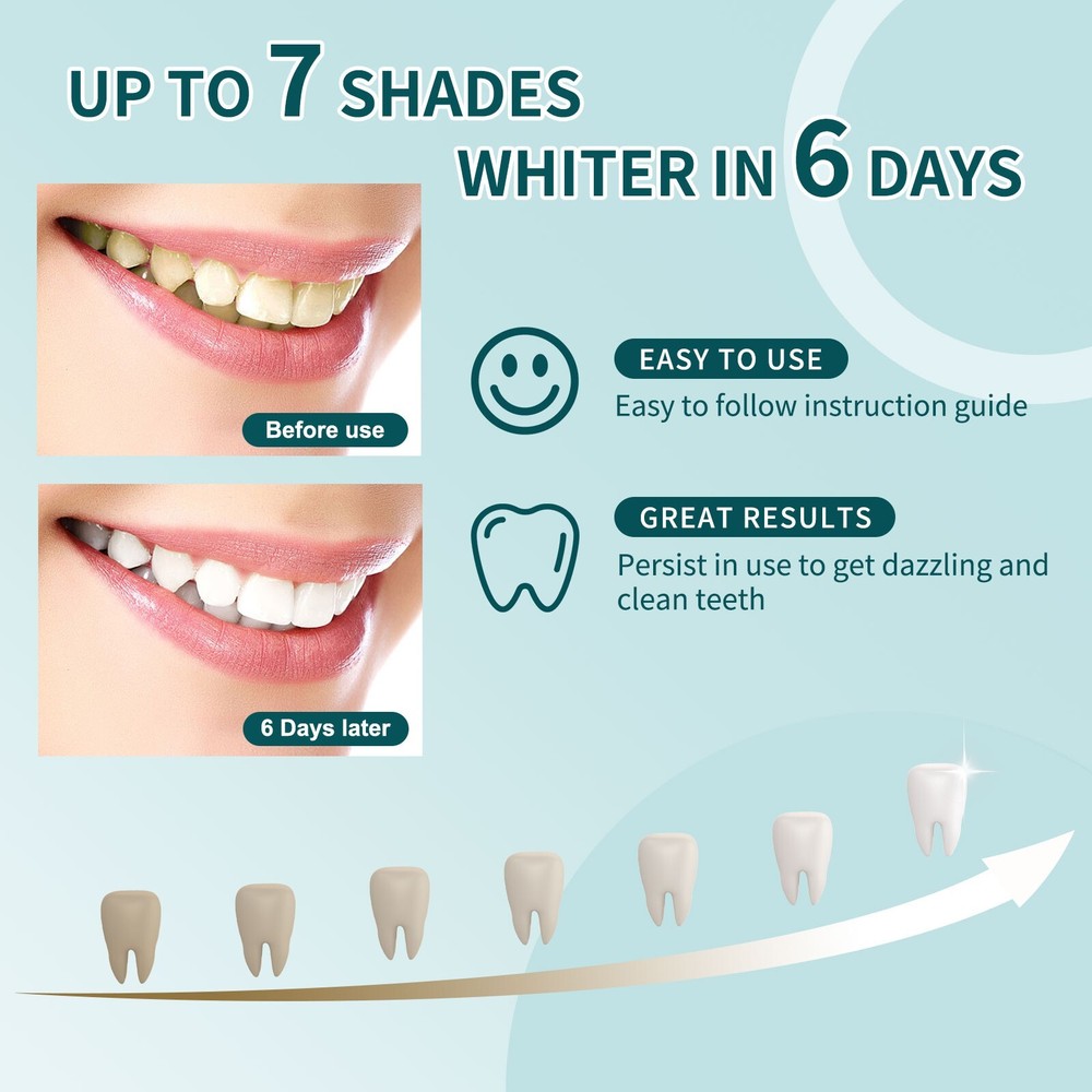 Teeth whitening GEL kit with LED light