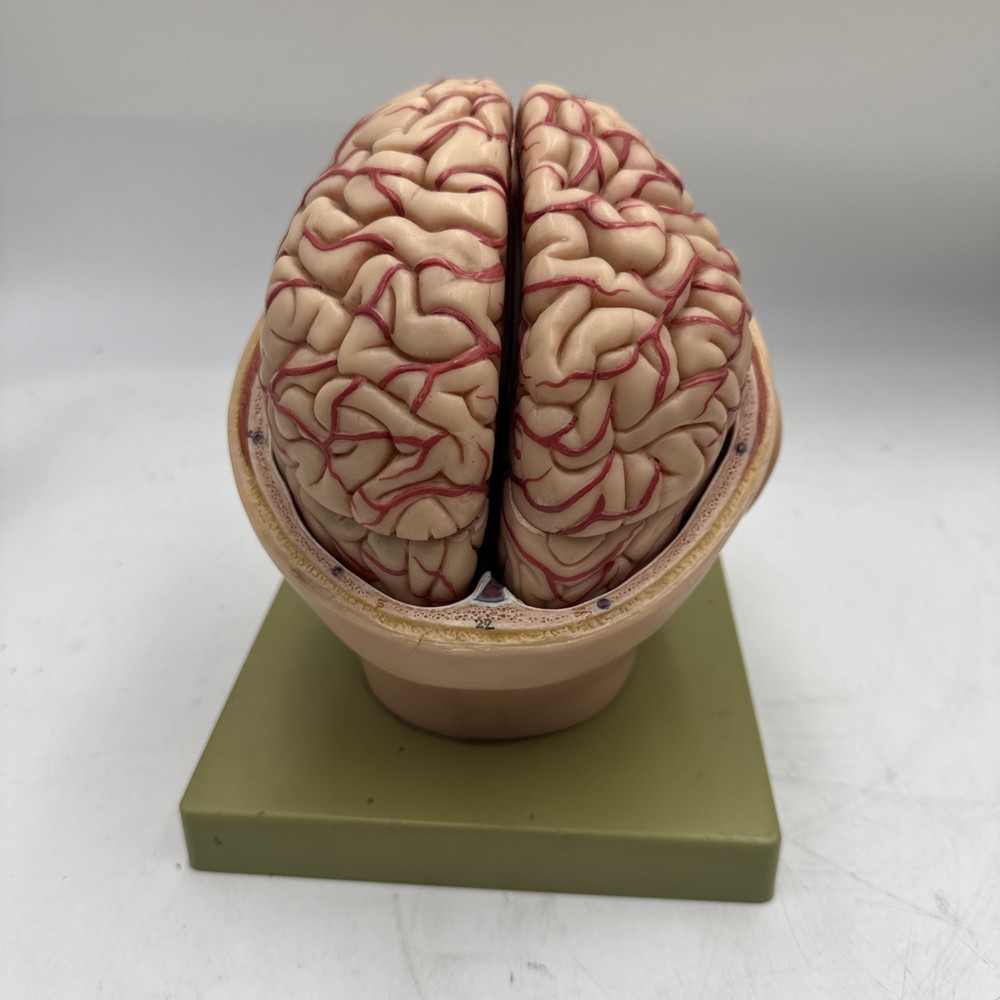 Somso Anatomical BS5 Head Base with Brain Model 9 Part BS 5