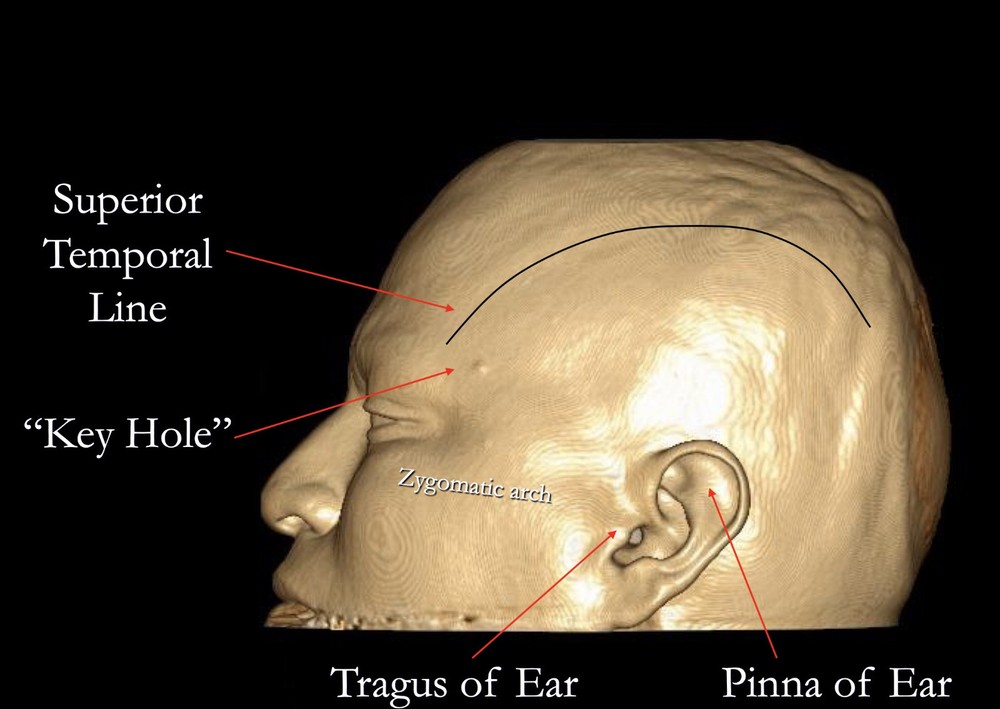 NEUROSURGICAL Basics Audio CD + 248 Page PowerPoint CD