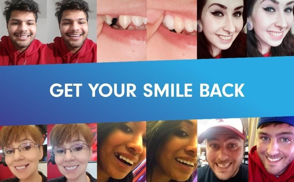 Natural-Looking Temporary Tooth Replacement - DIY Kit with Instructions