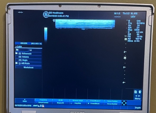 GE 8L-RS Linear Array Ultrasound Probe.