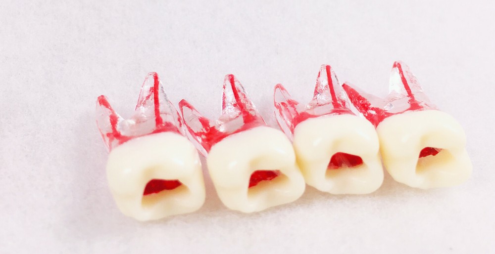 Dental Tooth Endo Root Canal Study Model For RCT Practice Blocks Pulp Cavity