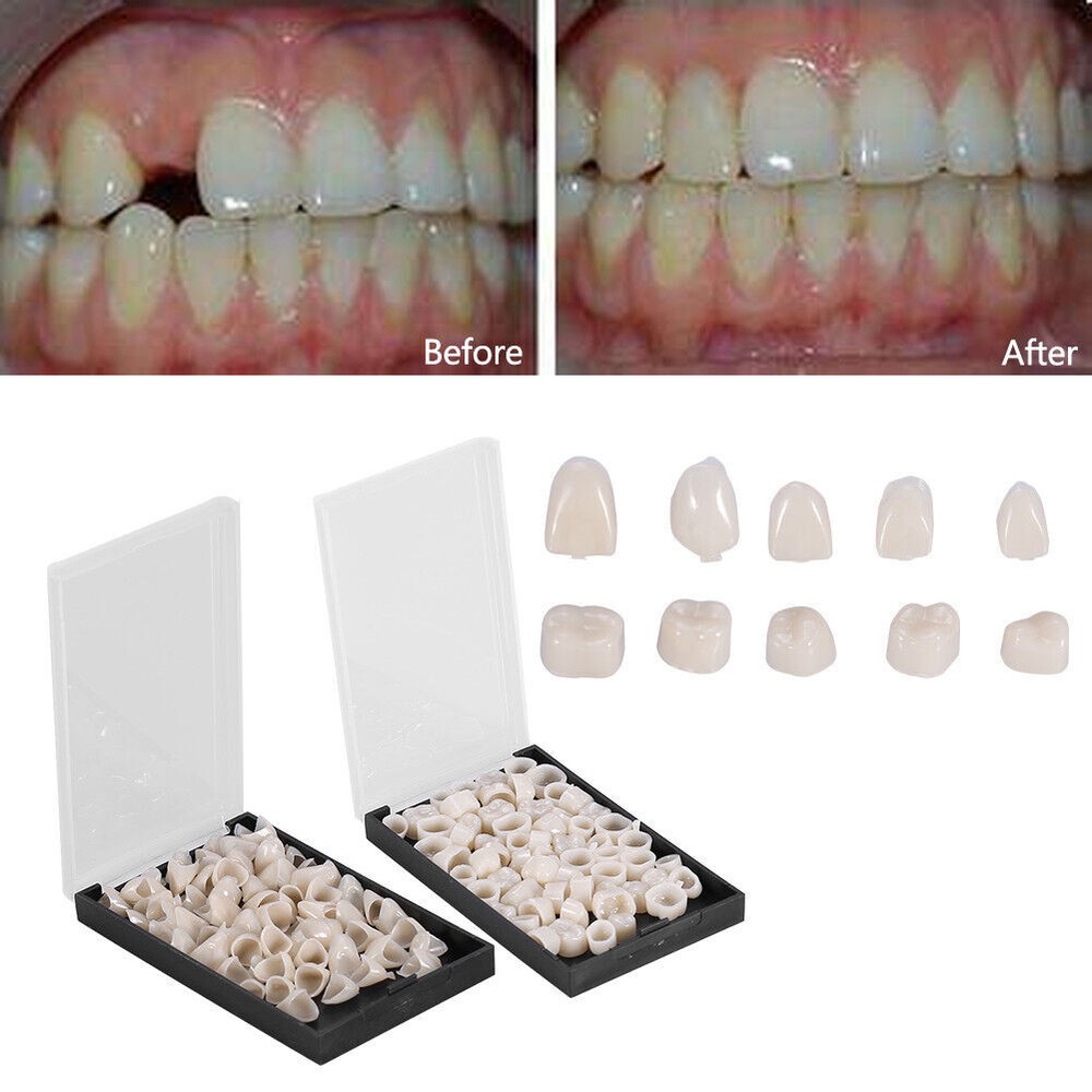 2 Boxes Dental Temporary Crown Veneers Material Anterior/ Front Back Molar Teeth