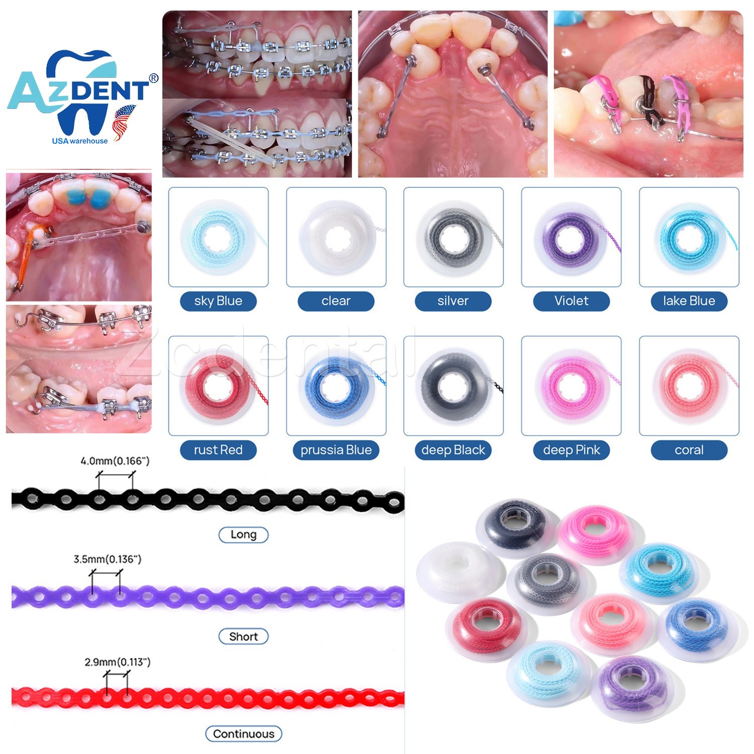 Dental Orthodontic Power Chains Braces Rubber Band Elastic Short Long Continuous