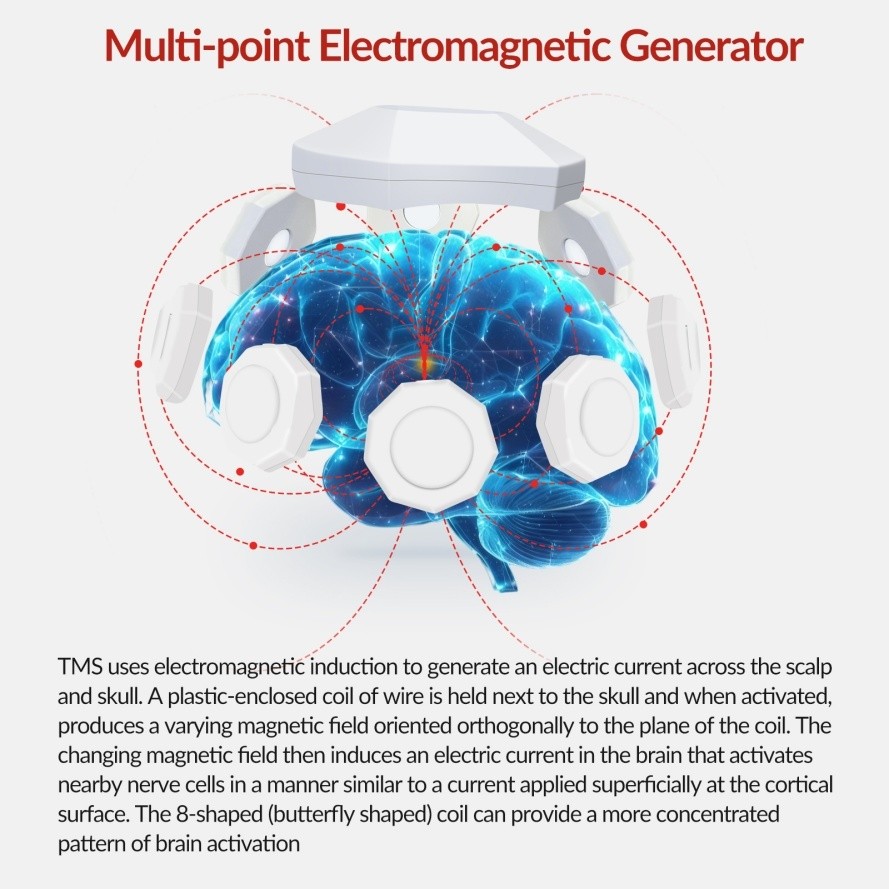 rTMS Brain Therapy Device For Memory & Cognitive Function Improvement