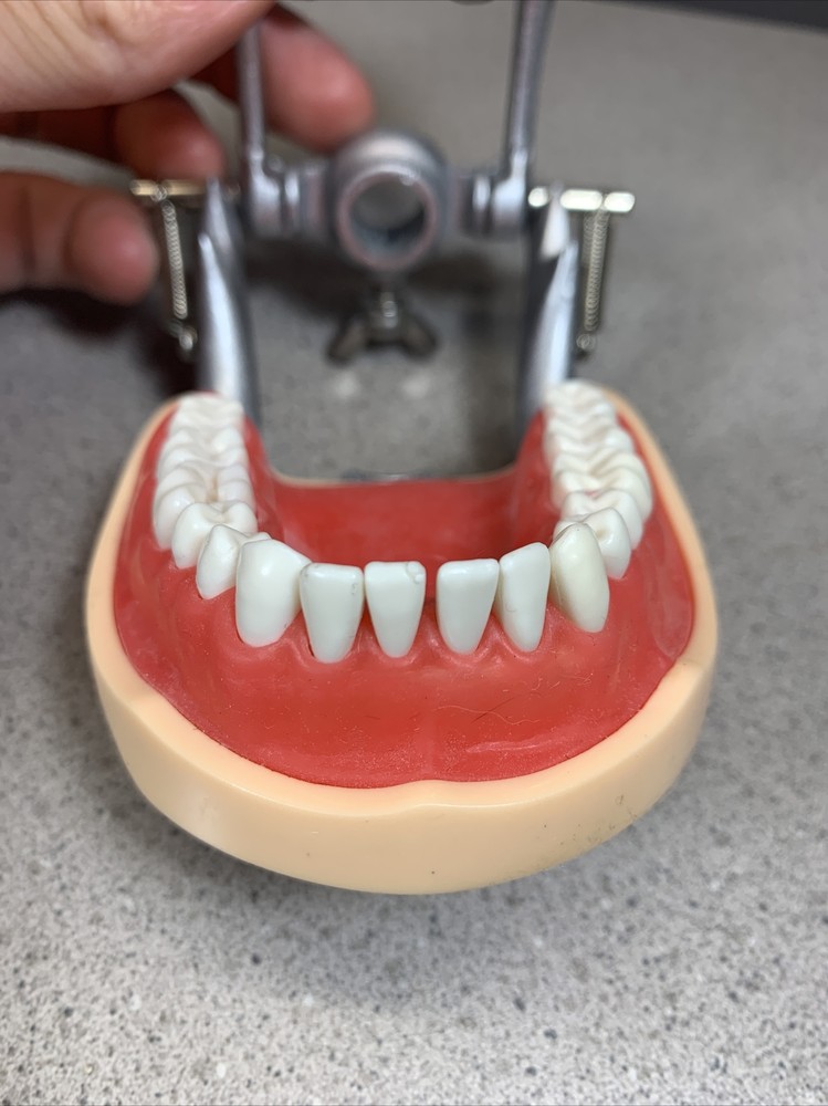 Dental Typodont Model With Removable Teeth Unbranded