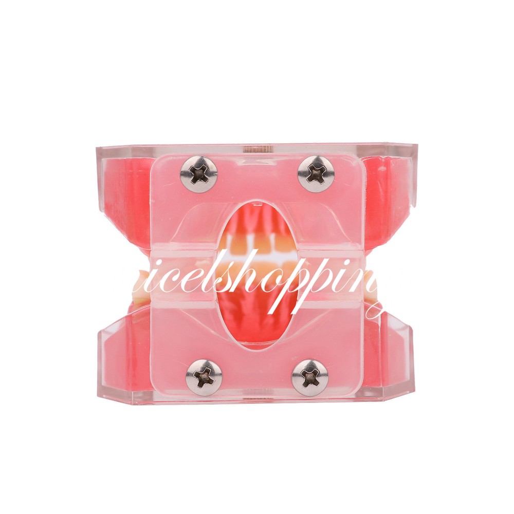 Dental Orthodontic Teeth Model 4004# with 28 Removeable Teeth Standard Plastic