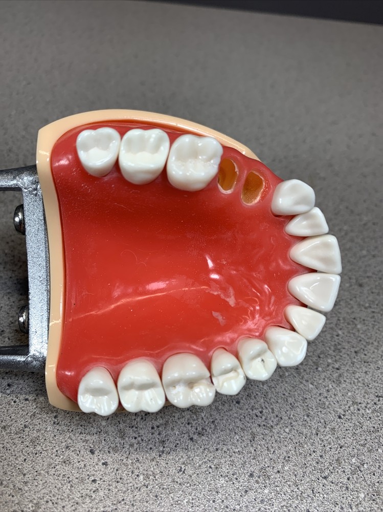 Dental Typodont Model With Removable Teeth Unbranded