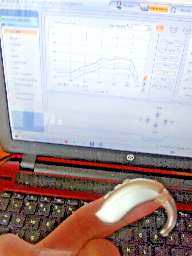 PAIR PROGRAMMABLE BEHIND THE EAR DIGITAL HEARING AID PROFOUND LOSS