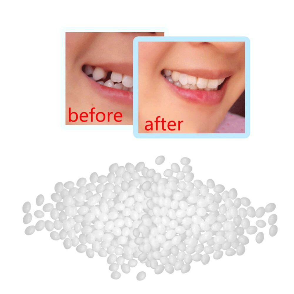 Moldable Teeth Beads Repair Kit - Temporary Fix for Missing, Broken or Gap Teeth
