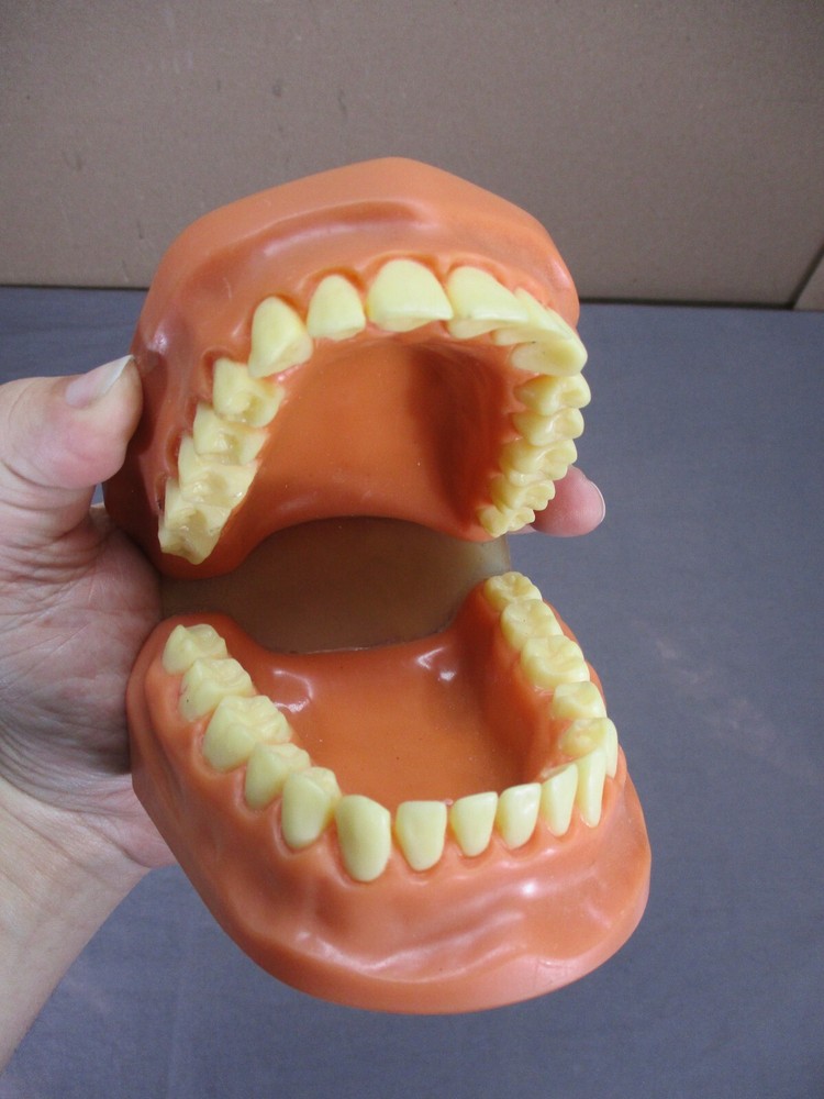 Dentist Typodont Dentoform Dental Model Teeth Overbite Tooth Display Hinged Set