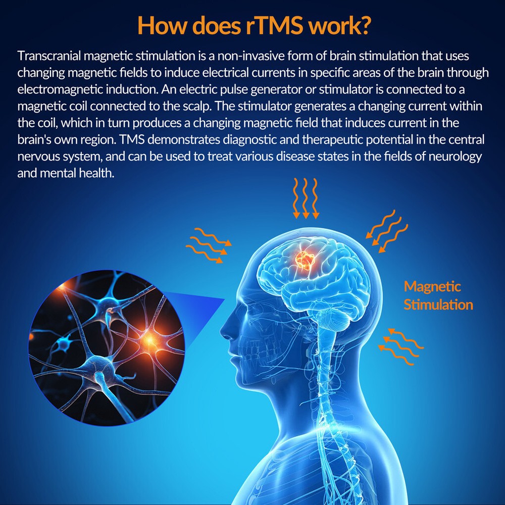 Transcranial Stimulation Therapy for Anxiety and Depression Brain rTMS Machine
