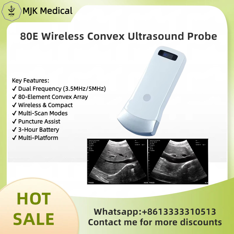 IOS Android Windows 80 Elements Convex Array Wireless Ultrasound Scanning Probe