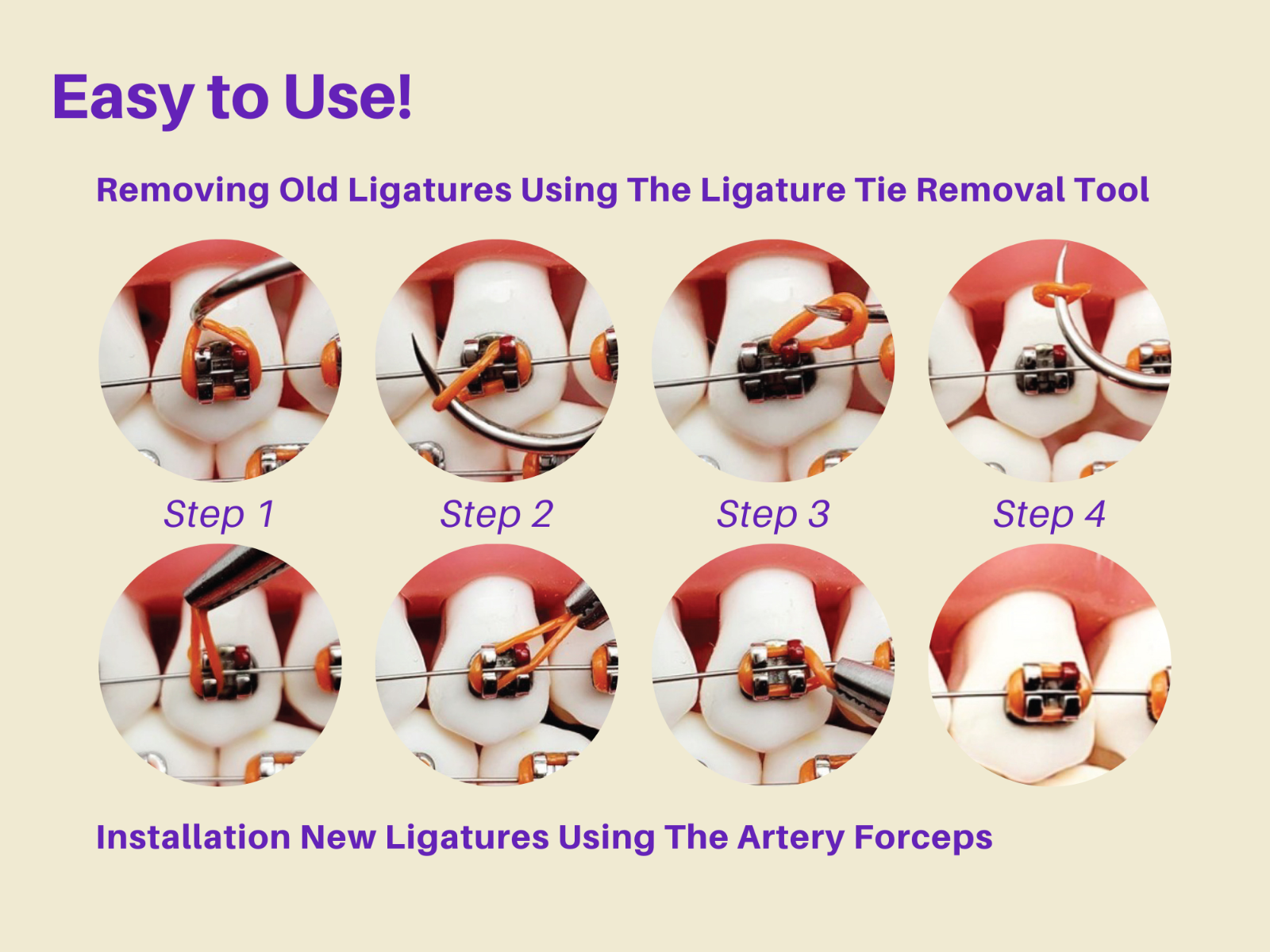 Dental Braces Color Changing Kit, Orthodontic Ties Changing kit ARTMAN