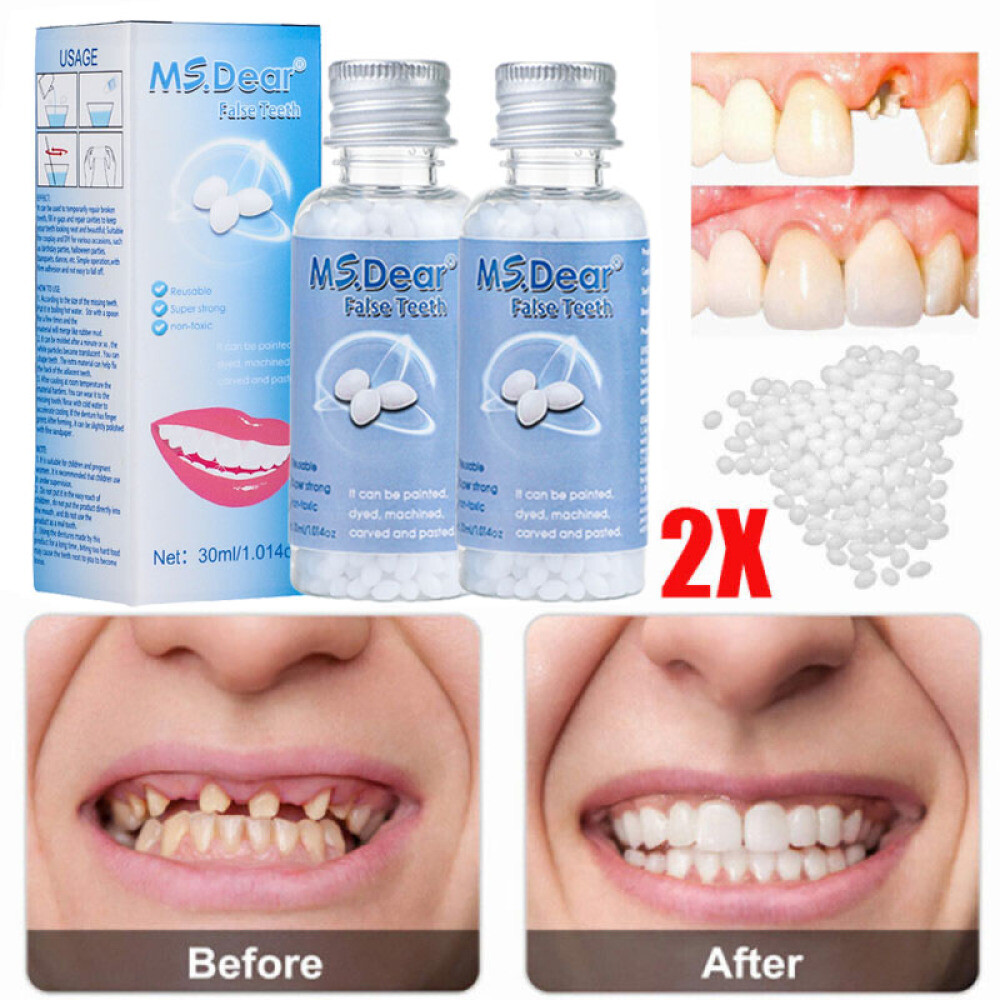 2X Temporary Missing Tooth Repair Kit Teeth And Gaps Solid Glue Denture Adhesive
