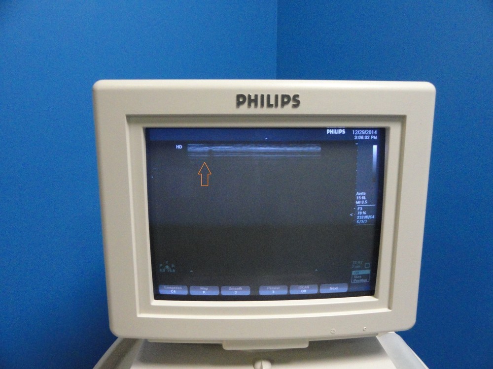 Philips HP 15‑6L Compact Linear Array Transducer – For HP 5500 & EnVisor ~ 8452