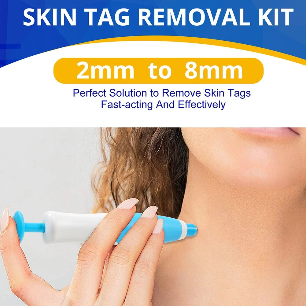 Auto Micro Skin Tag Remover Device Kit Safe Painless Removal 2-8 mm Band Tool