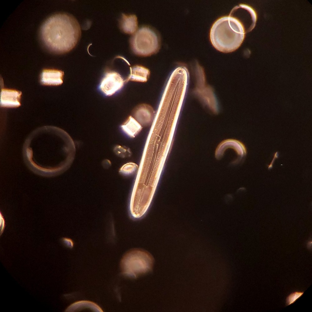 American Optical Darkfield Oil Condenser