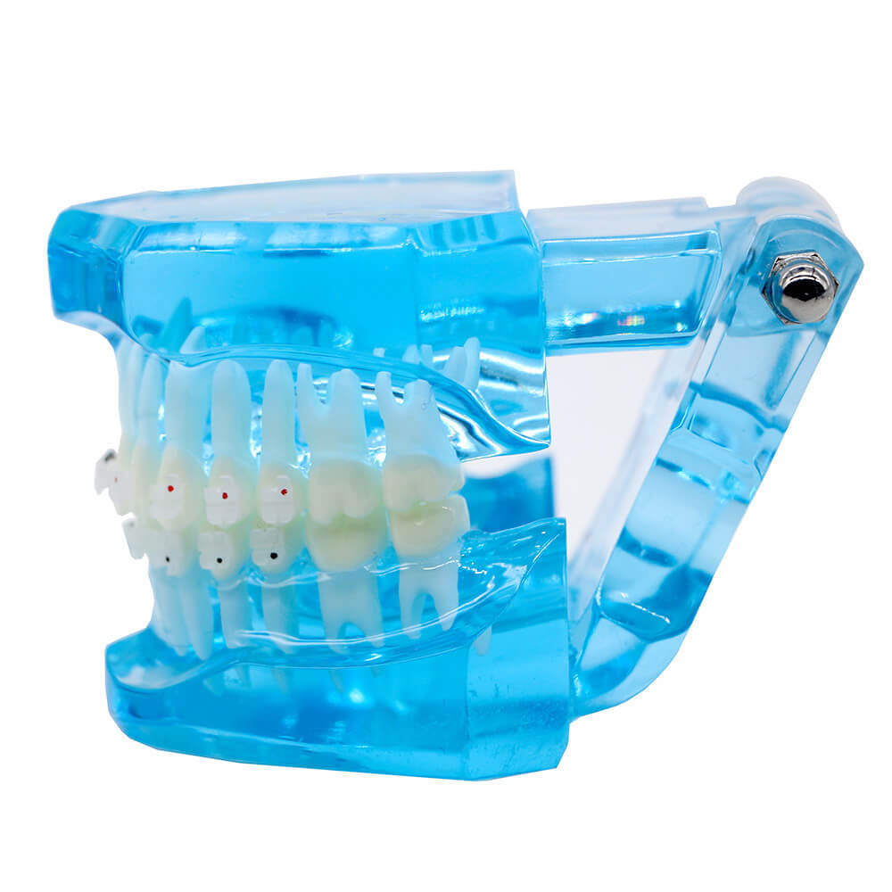 Dental orthodontic teach study teeth model mental and ceramic bracket contrust