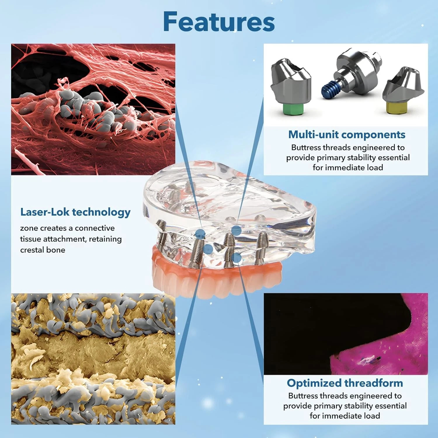 Dental Implant Restoration Model Upper Jaw 6 Screws Post Core Bridges M6001-2 US
