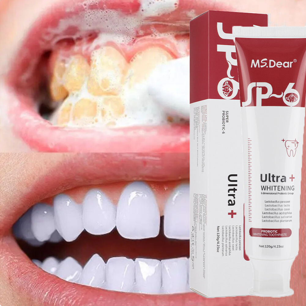 2Pack SP-6 Probiotic Toothpaste,Sp-6 Toothpaste Whitening Quick White Toothpaste