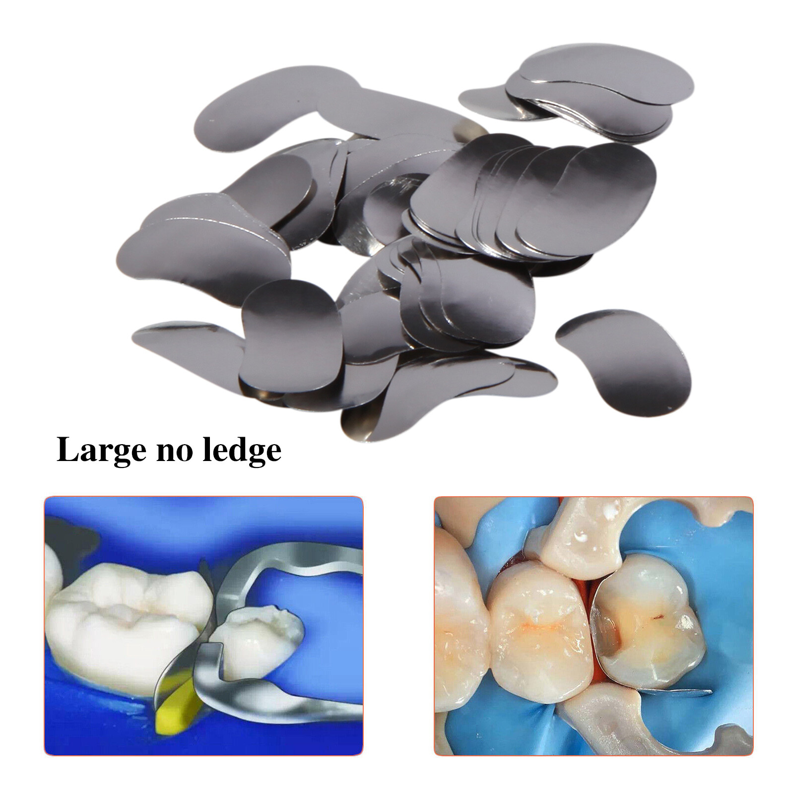 Dental Metal Matrices Matrix Band Sectional Contoured Refill Box S/M/L USA