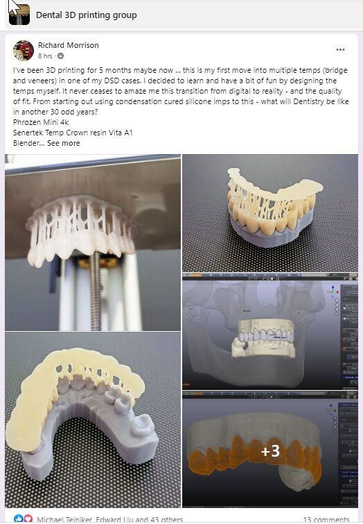 DLP SLA LCD 3d printer temporary teeth resin ..