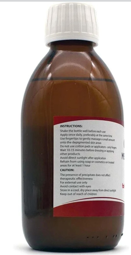 vitiligo treatment Lotion