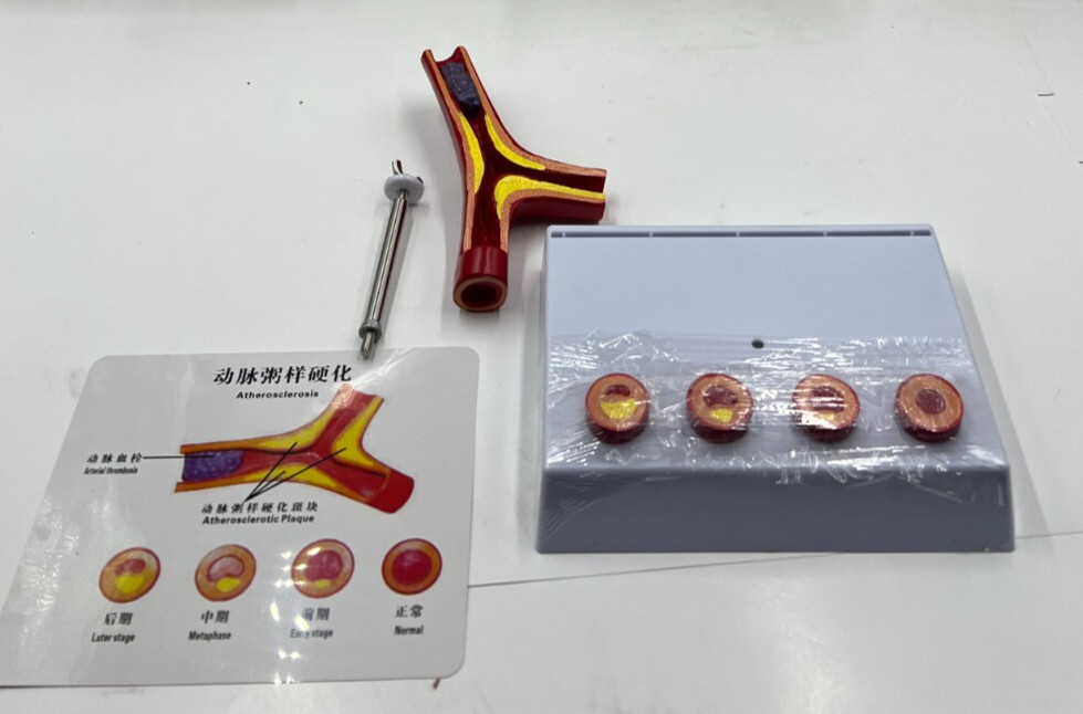 Human Atherosclerosis Cardiovascular Model Blood Vessel Thrombosis Model