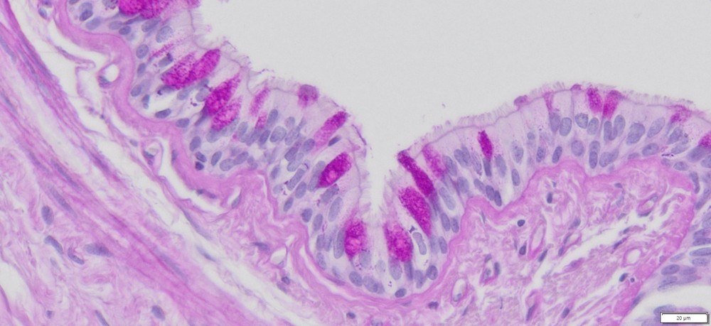 VitroView™ PAS Stain Kit (Cat#VB-3004)