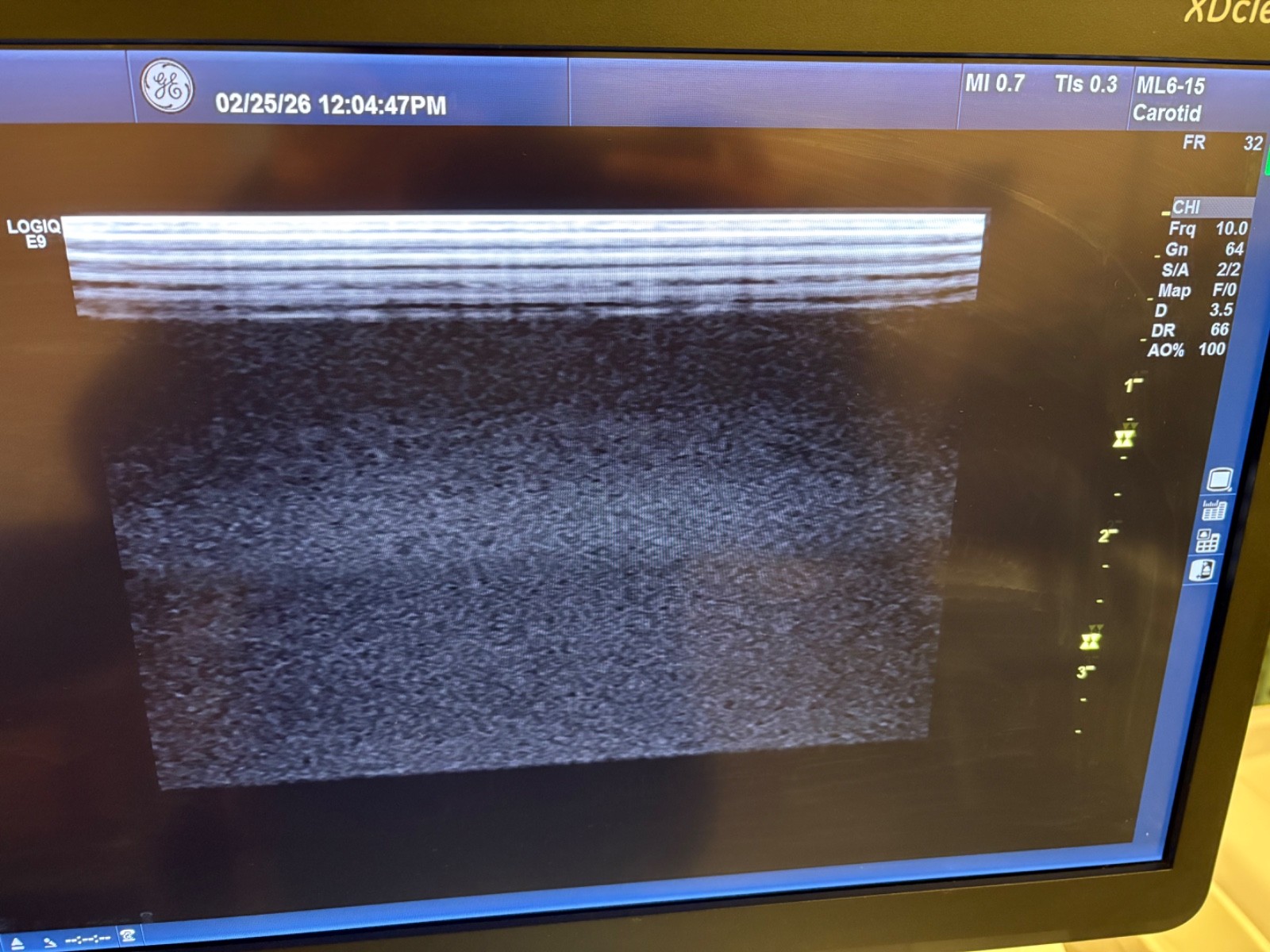 GE ML6-15-D Probe REF 5199103, SN 151327YP4, MFR Date 2014/08 * See Description