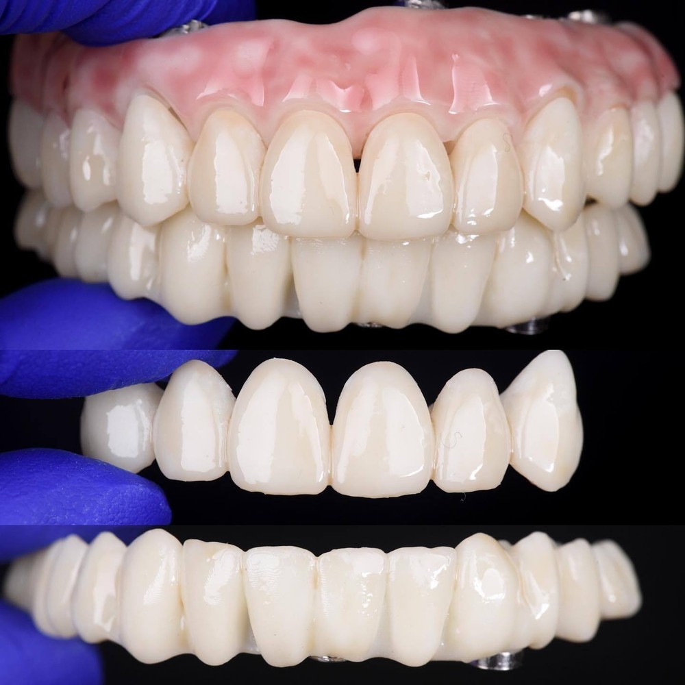 DLP SLA LCD 3d printer TRY-IN - dentures and teeths testings