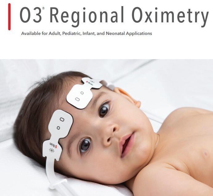 Masimo O3 Regional Oximeter (MOC-9) Module (NEW) REF:9637 - OEM Packaging