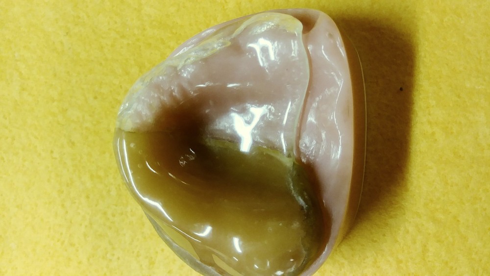 Cleft Palate DENTAL LAB DEMONSTRATION TEACHING MODEL Lab. Dentist ODD RARE