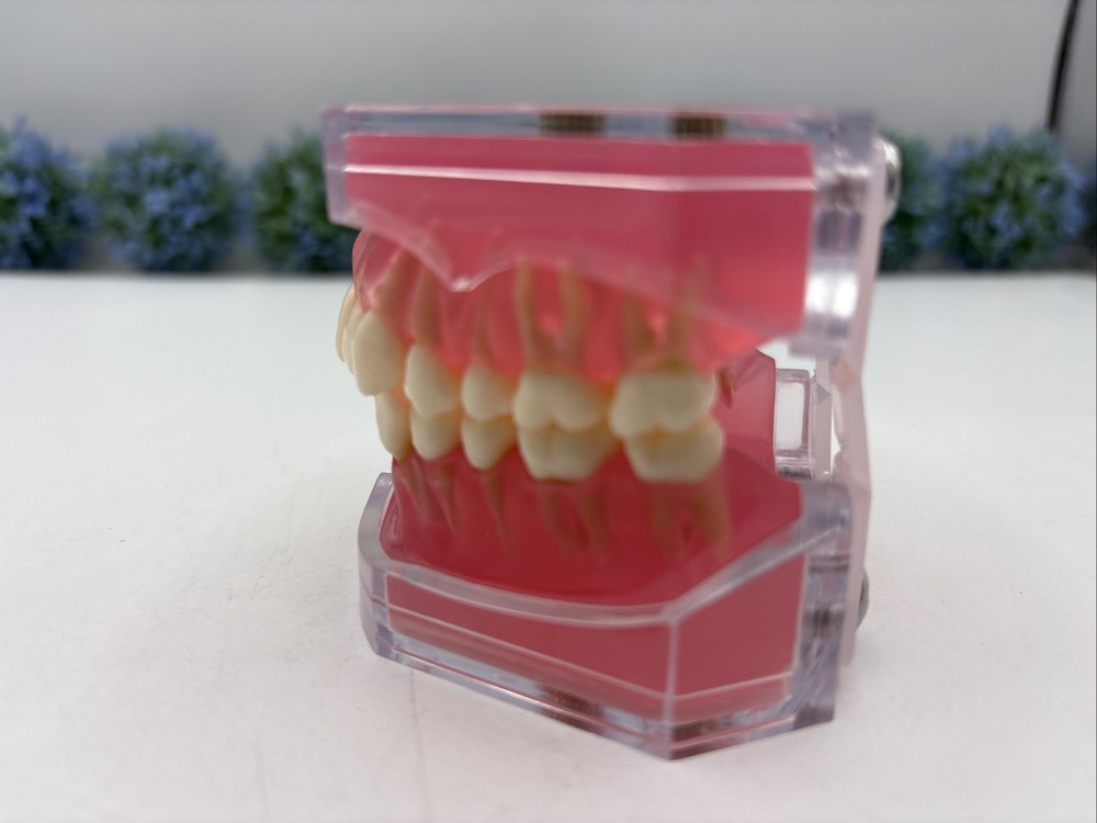 Dental Typodont Practice Removable Teeth Model M7008