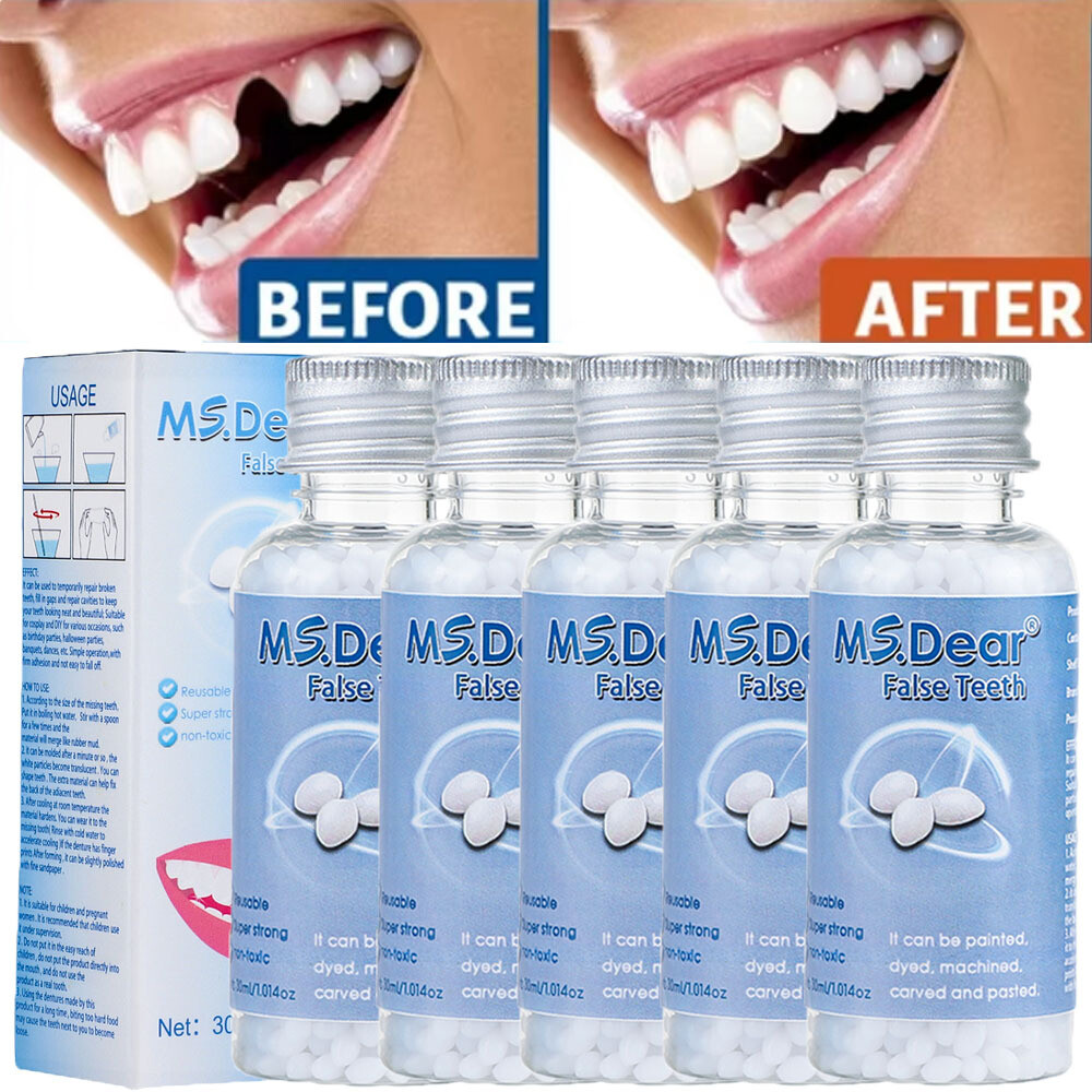 5-1x Tooth Repair Granules Temporary Reusable Moldable False Teeth Fitting Beads