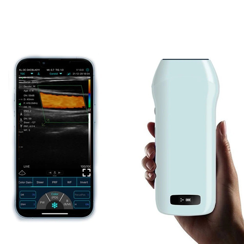 Portable Wireless Ultrasound Scanner - HD Linear Array Color Doppler