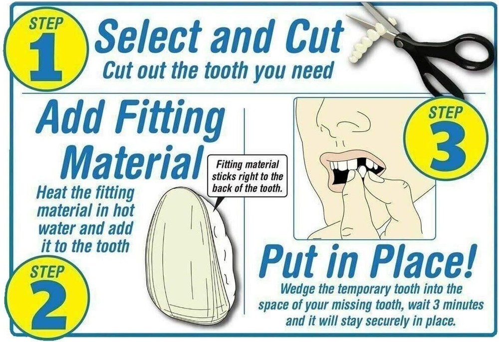 Instant Smile Emergency Temporary Tooth Replacement Kit