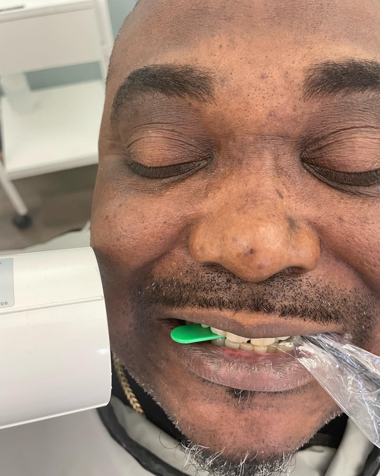 5 pcs Autoclavable - Apical/Bitewing Adult Digital Sensor Positioner-Holder