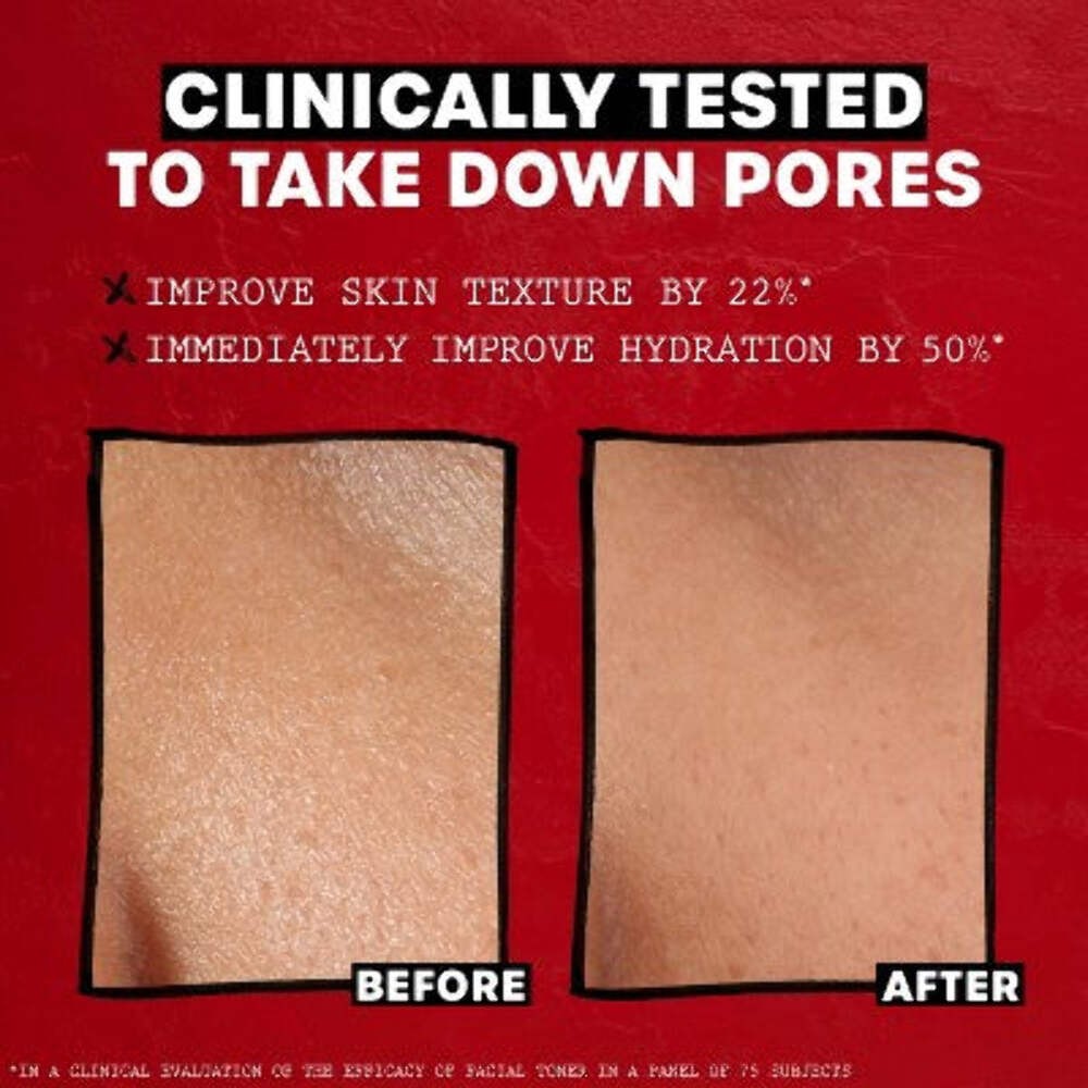 Thayers Remedies Witch Hazel Alcohol Free Lavender Facial Toner 12 fl oz - New