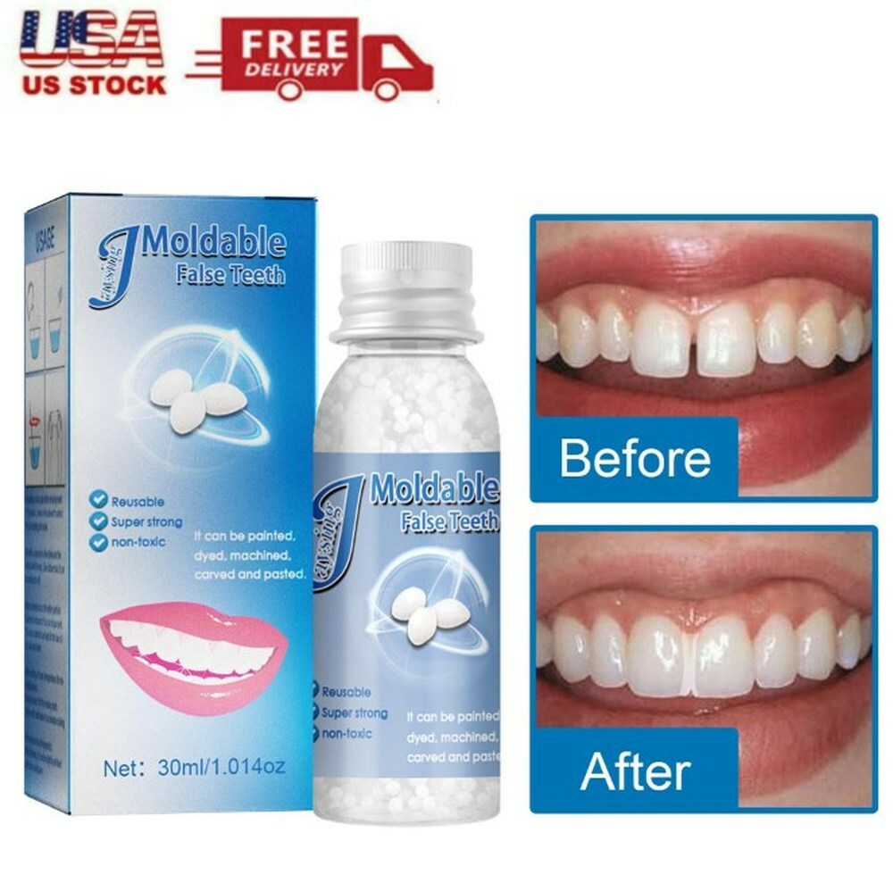 Temporary Tooth Repair Moldable Fix Broke Gap Teeth False Teeth Solid Glue