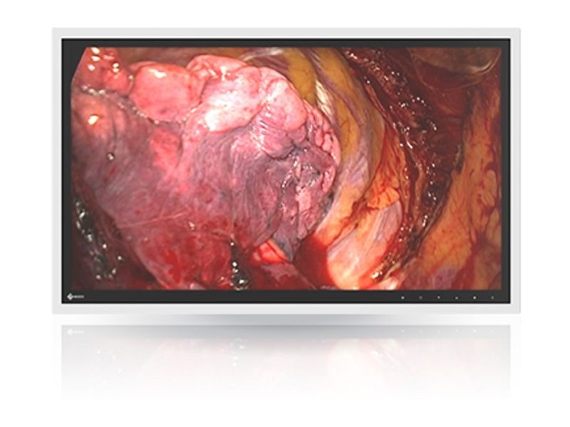 Eizo RadiForce EX270W 27" FHD Surgical LCD Monitor