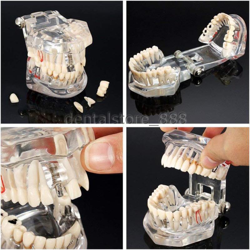 3D Human Teeth Gums Model Dentist Training Teaching Education
