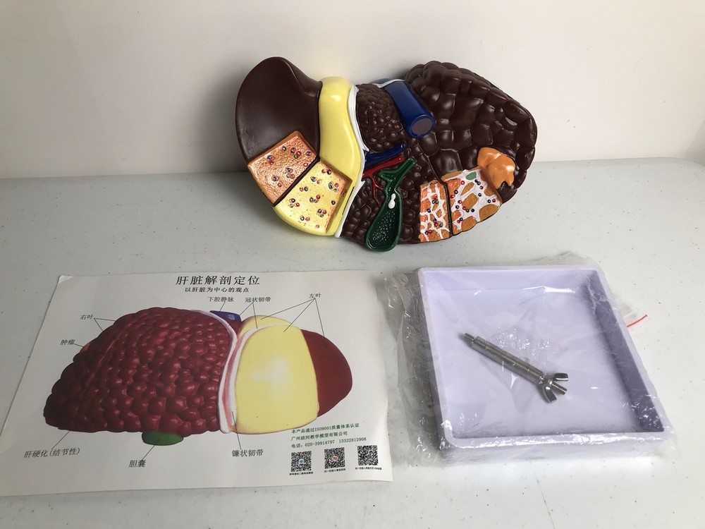 Pathological Liver Anatomical Model 1:1 Human Liver Model Anatomy Display Study