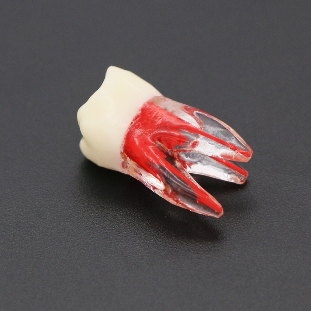 Dental Teeth Root Canal RCT Block Pulp Cavity Practice Model for Endo File Study