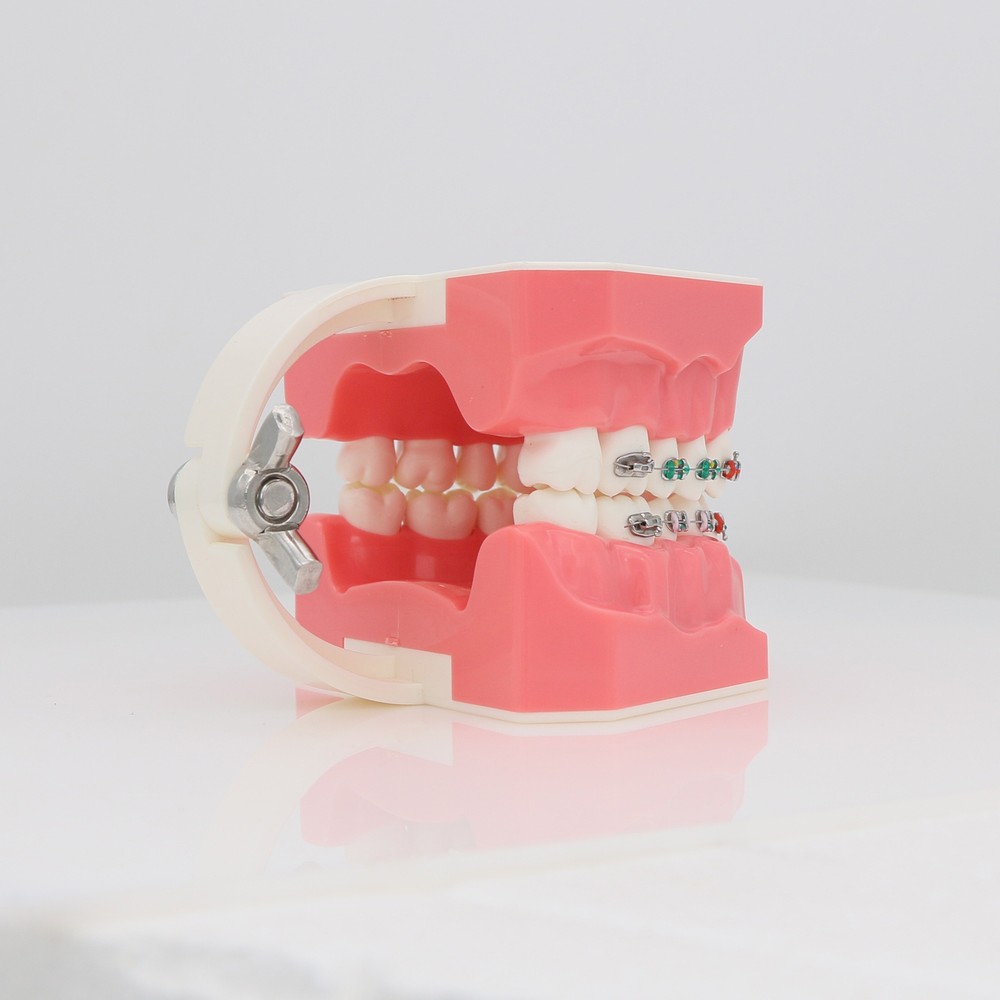 Dental Orthodontic Teeth Model Typodonts Model Demonstration Model with Brackets