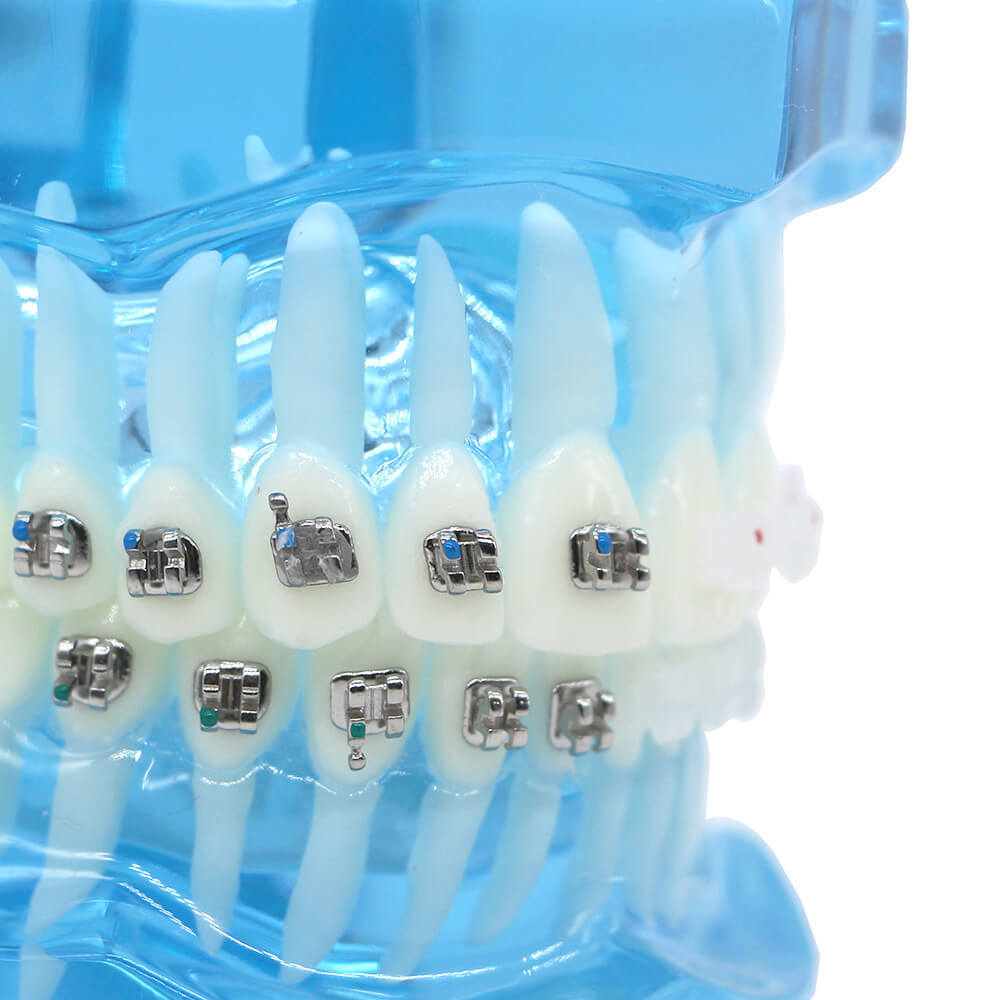 Dental orthodontic teach study teeth model mental and ceramic bracket contrust