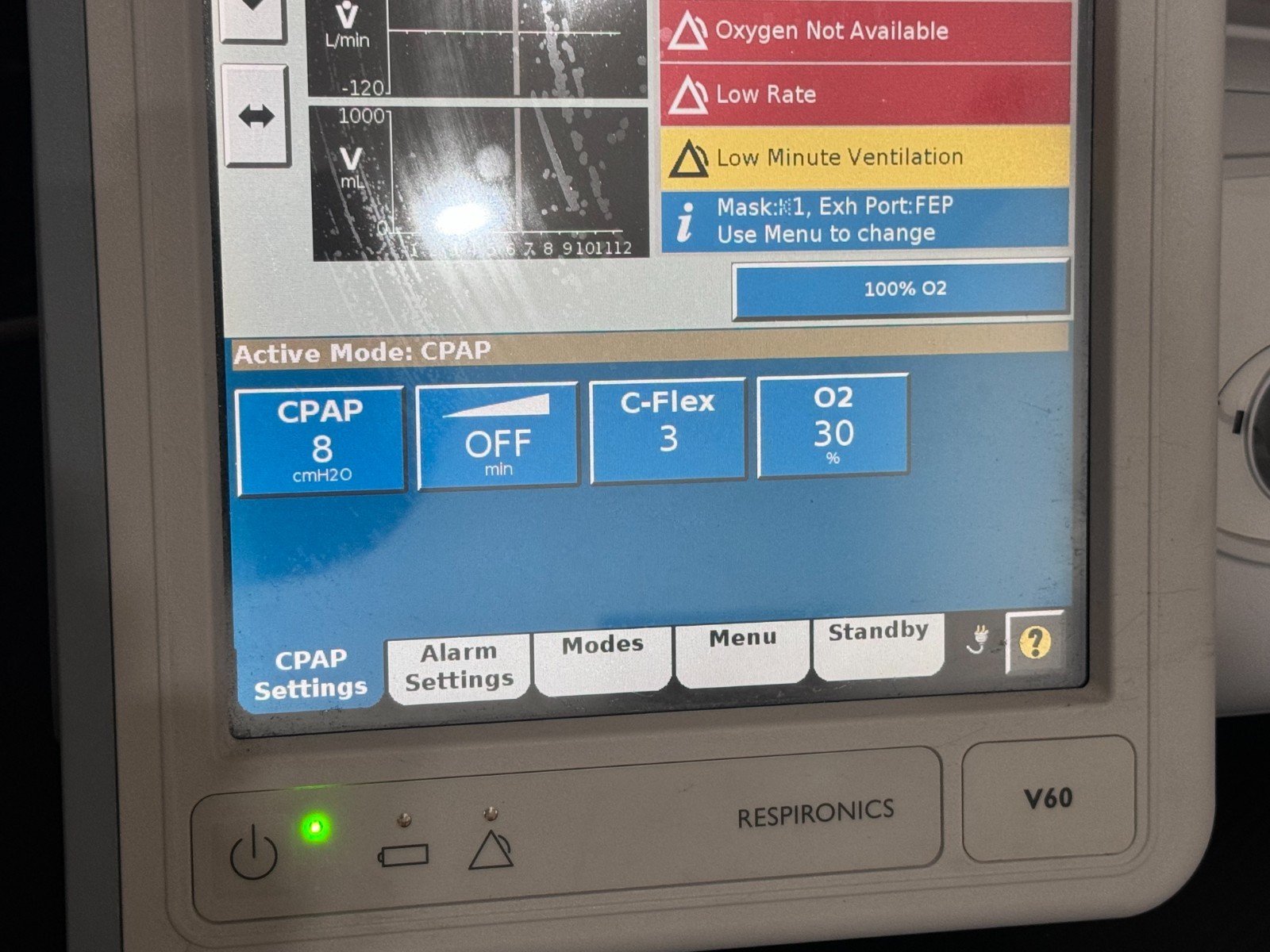 Philips V60 System 1033544