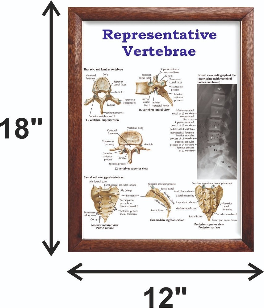 Representative Vertebrae Chart 12x18 inches