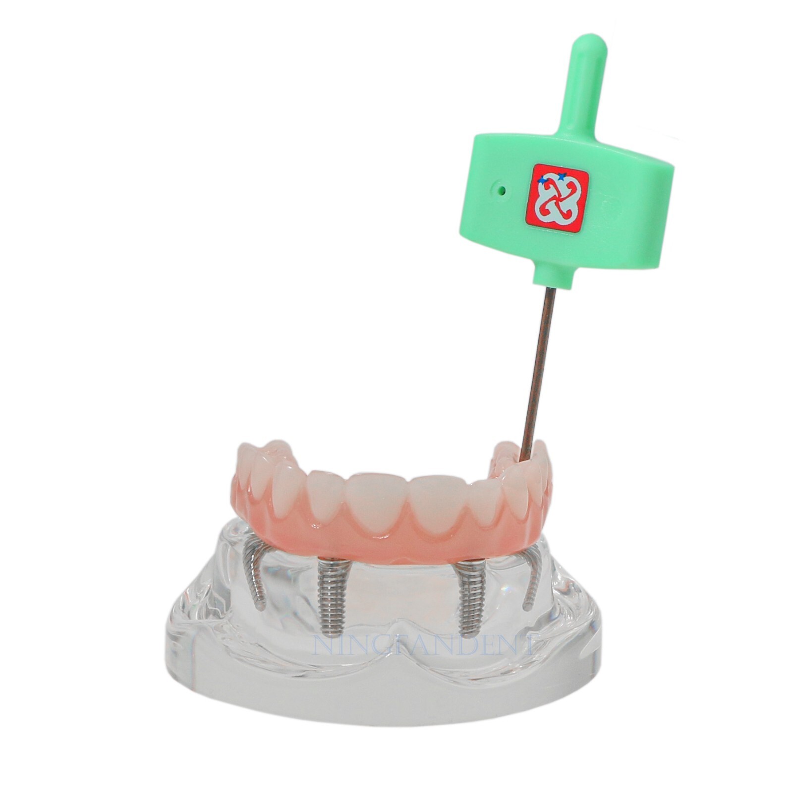 US Dental All-on-4 Overdenture treatment Implant Model Upper 4 Implants Clear